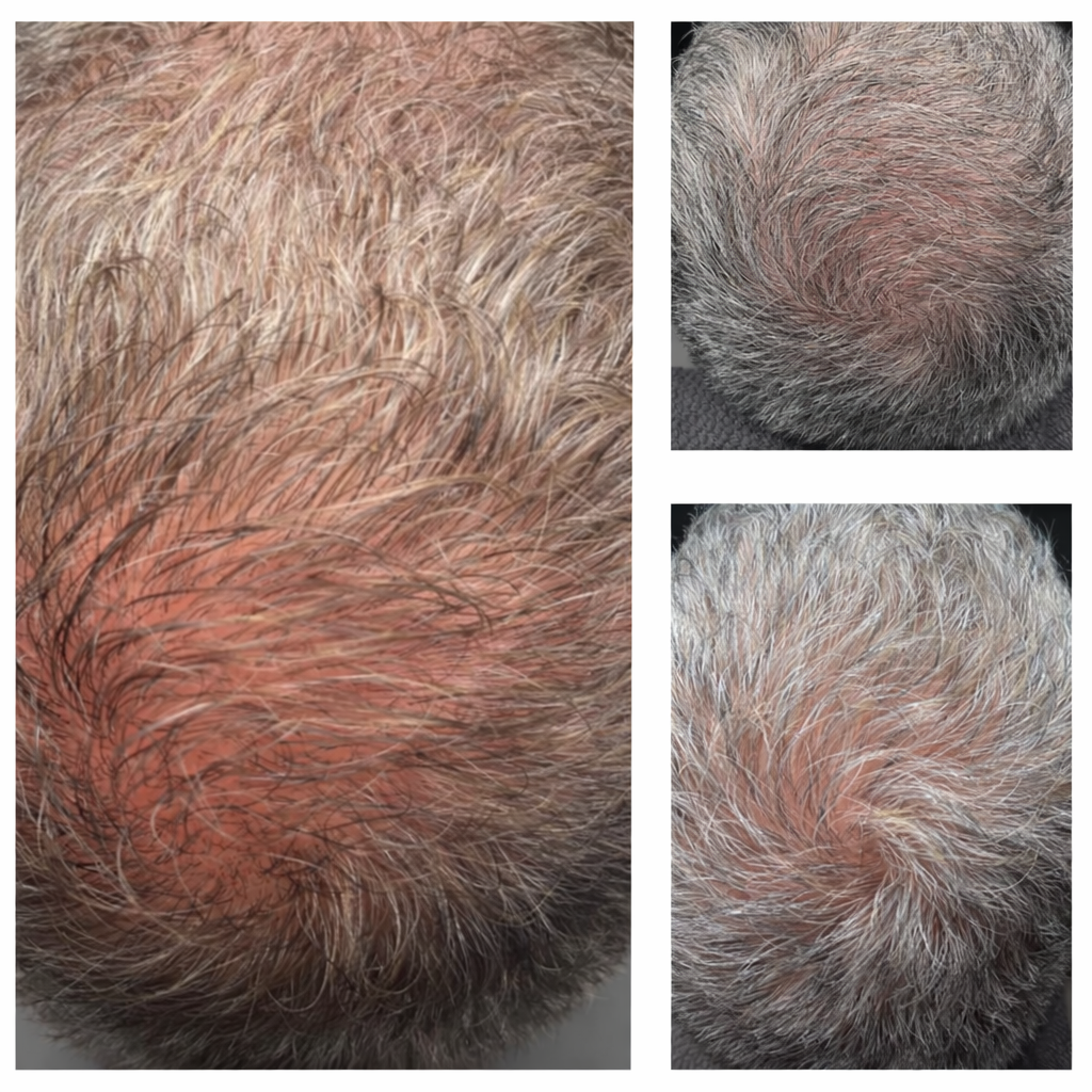 Scalp treatment before and after results